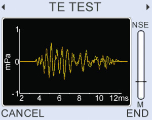 (OPTIONAL TEOAE) 
Live TEOAE waveform