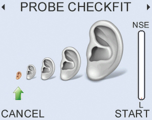 In-ear calibration ensuring accurate results with customizable stimulus levels 60-84dB 1dB steps
