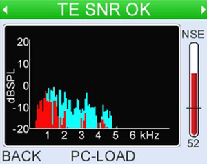 Comprehensive TEOAE analysis. , high resolution spectrum