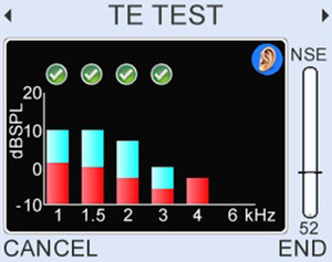 View TEOAE signal and noise
histogram