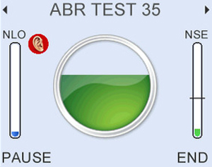 Clear test progression. It checks for changes in noise levels and electrode impedance which may prevent progress, giving helpful on screen alerts