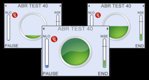 See test progress every step of the way.
For AABR there is continuous monitoring of Fsp and ABR waveform shape to ensure that a ‘clear response’ is a true response.
