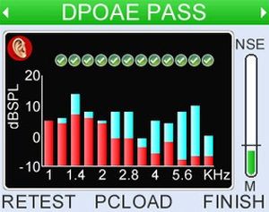 High quality 12 frequency bar DPgrams or higher resolution with normative range markers from 1-8kHz up to 4pts/octave and or higher resolution