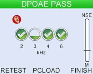 Fast and clear Pass/Refer result 2, 3,or 4 bands pass criteria.